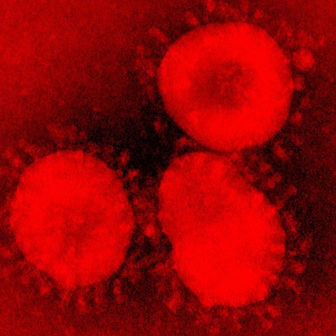 Diario Frontera, Frontera Digital,  CORONAVIRUS, Salud, ,Confirman los dos primeros casos de coronavirus en Inglaterra