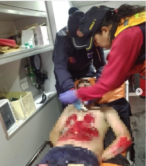 Diario Frontera, Frontera Digital,  ARROLLADO JOVEN, HUMBOLDT, MÉRIDA, Sucesos, ,Joven lesionado tras ser arrollado por un vehículo 
conducido por una ciudadana en Mérida