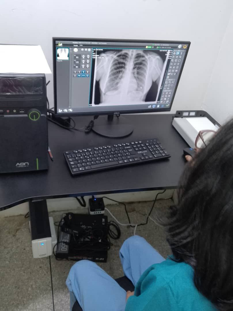 Diario Frontera, Frontera Digital,  Salud, ,Incorporaron equipos de alta tecnología a hospitales de Mérida