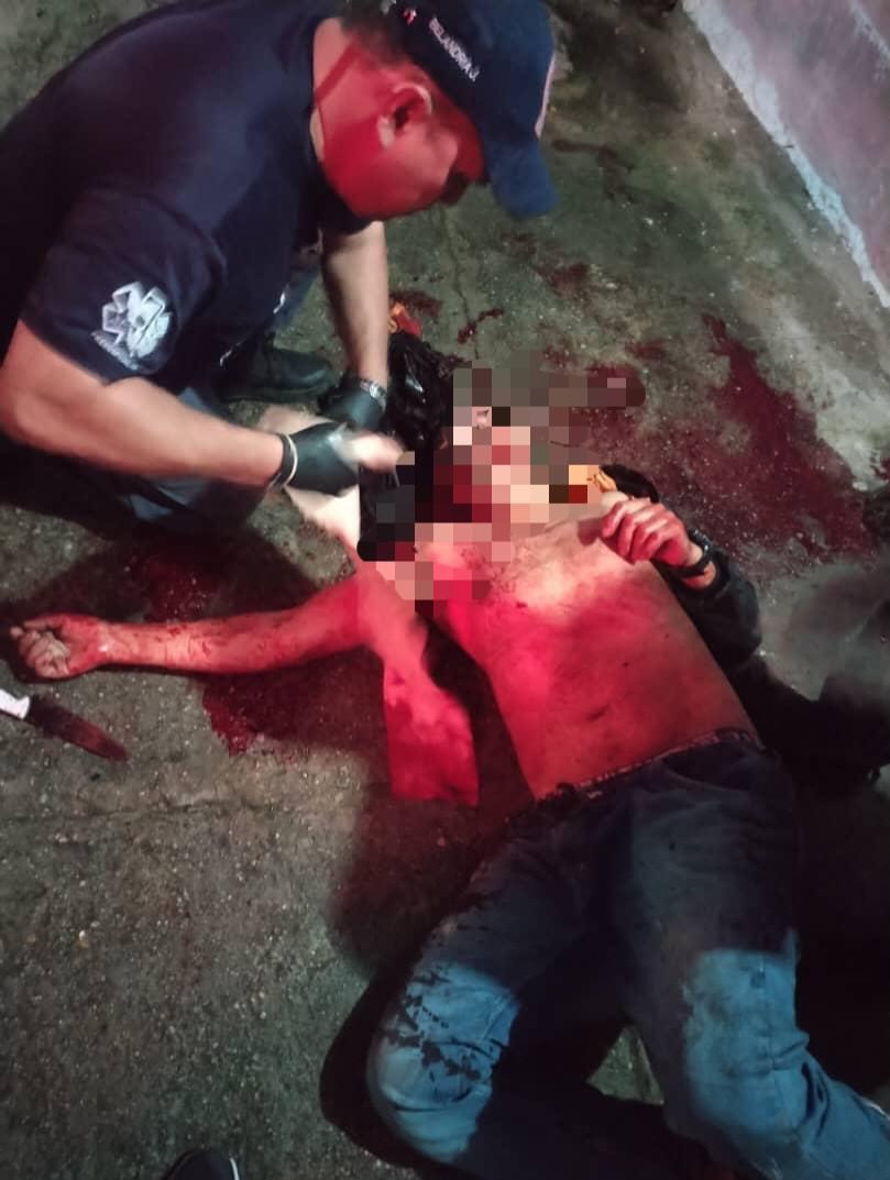 Diario Frontera, Frontera Digital,  Sucesos, ,Siguiendo el protocolo legal establecido para casos de muerte violenta, el cadáver fue trasladado al Servicio de Medicatura Forense para la realización de la necropsia de ley,Falleció ciudadano atacado con arma blanca en Zea