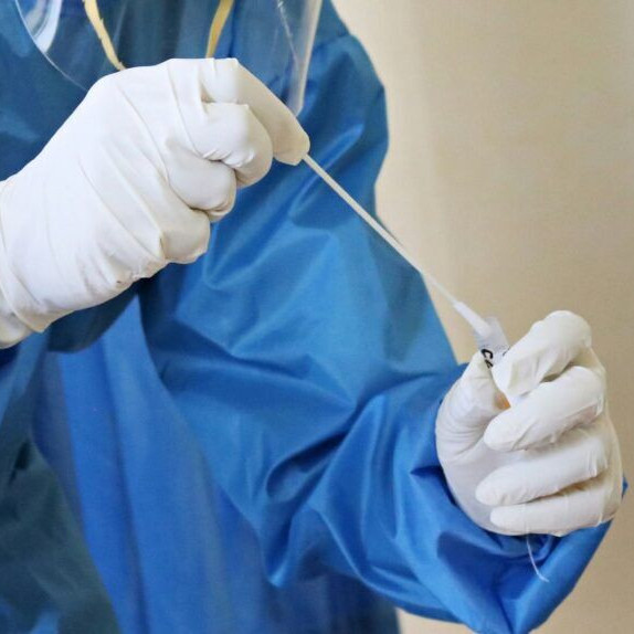 Frontera Digital,  Nacionales, Salud,  Ministerio de Salud confirmó tres muertes por hantavirus en Anzoátegui y descartó contagio entre personas